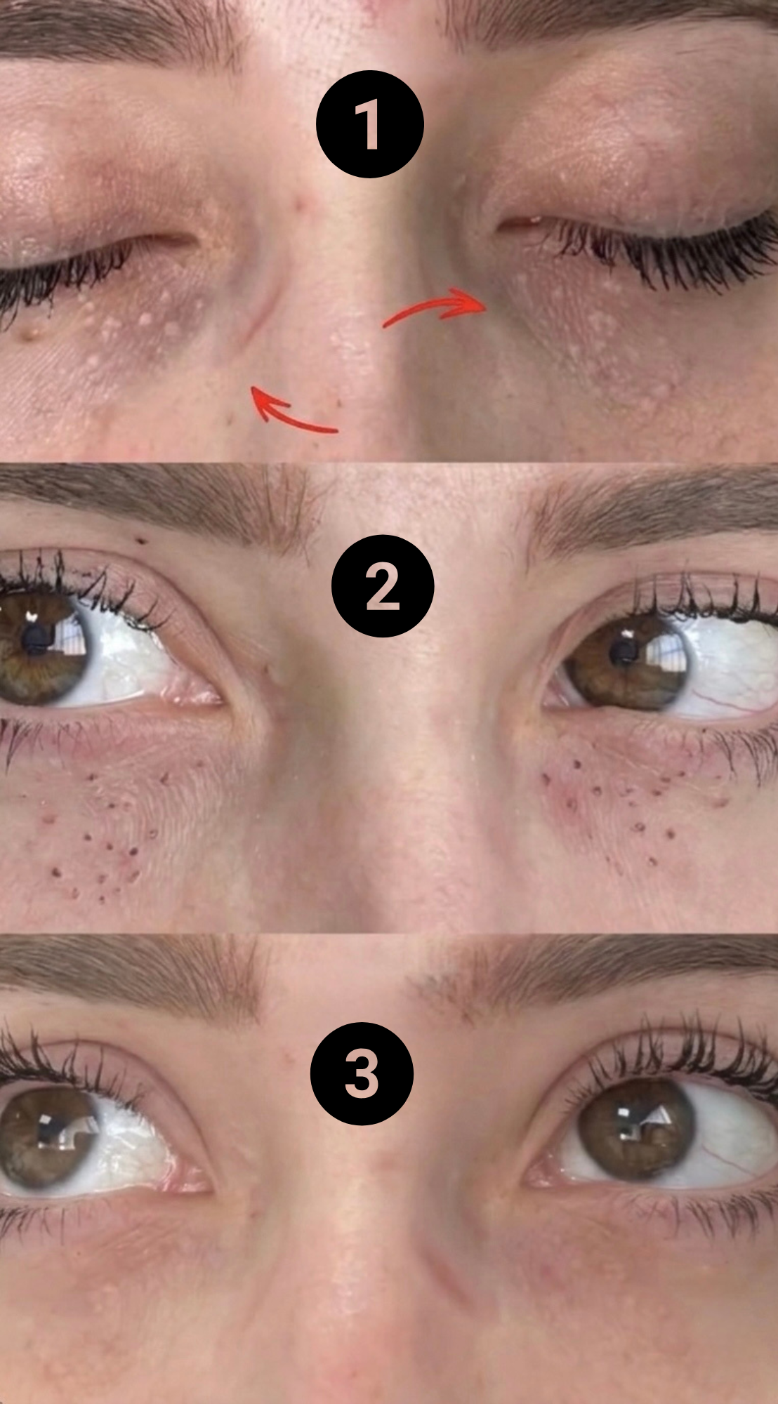 Set DermaClear corrector™ 